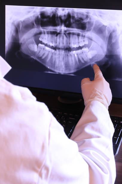 Best Emergency Root Canal Treatment in Montpelier, VT