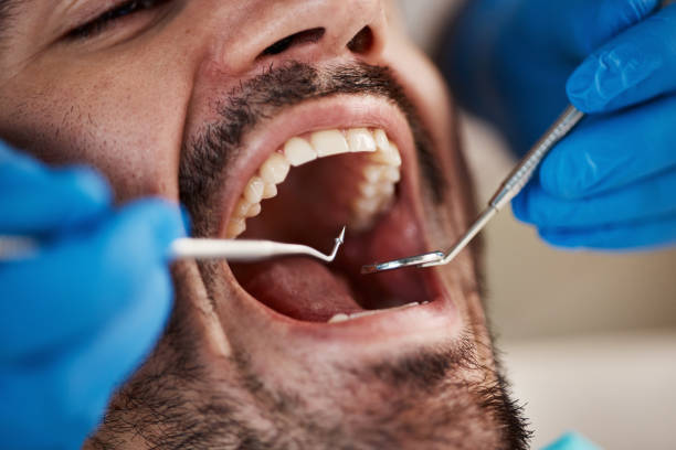 Best Emergency Treatment for Dental Infections or Abscesses in Montpelier, VT